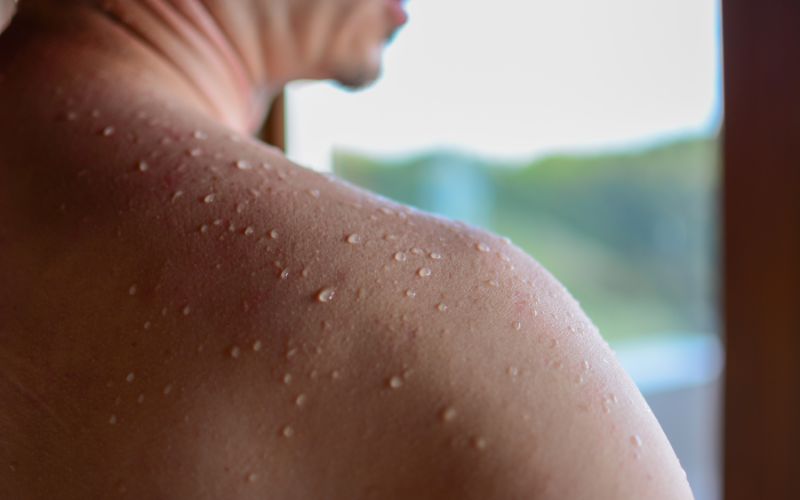 Xông hơi giúp bài tiết tốt